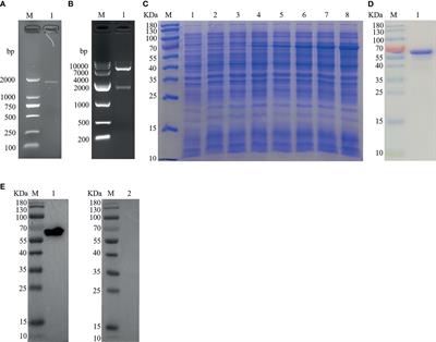 The GT1-TPS Structural Domain Protein From Haemonchus contortus Could Be Suppressive Antigen of Goat PBMCs